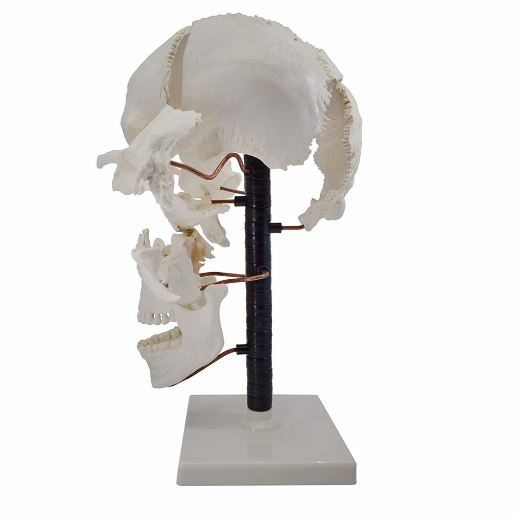 Exploded Skull Model 22 Parts - Life Sizeskull - Ravi Scientific Industries